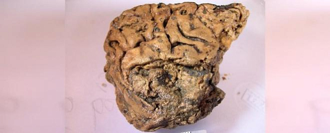 Археологи выяснили, почему сохранился мозг человека, умершего в V веке до нашей эры 