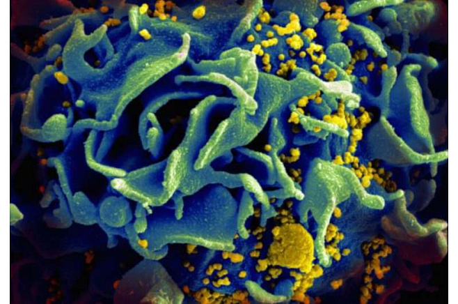 Выявлен второй случай естественного выздоровления от ВИЧ