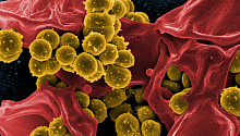 Бактерия, вызывающая язву, эволюционирует вместе с человеком 