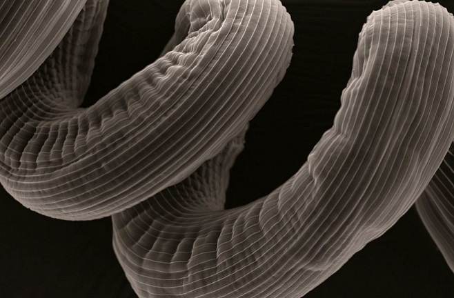 Личинки червей могут помочь в борьбе с астмой