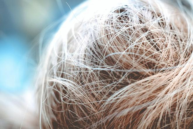 Уровни гормона фертильности можно определить с помощью волос 