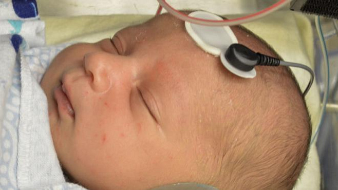 Проверка остроты слуха поможет выявлять аутизм у новорожденных 