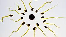 Люди, зачатые с помощью донорской спермы, чаще страдают от иммунологических заболеваний 