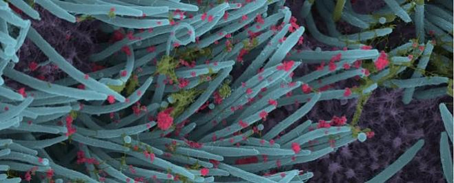Ученые получили новое изображение вирусных частиц SARS-CoV-2, заразивших легкие 