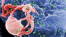 Биологи впервые проследили, как ВИЧ проникает в человеческие клетки и вставляет свой геном в их ДНК
