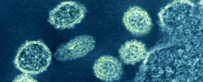 В Китае выявлен новый штамм свиного гриппа, передающийся от животного к человеку