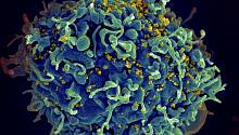 ВОЗ: Наличие ВИЧ повышает риск смерти от COVID-19