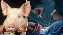 Пересадка свиного сердца человеку случится в ближайшие 3 года