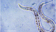 Новые способы лечение болезни Паркинсона обнаружены благодаря червю