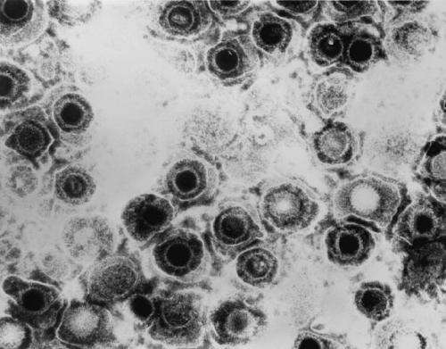 Исследователи смогли остановить репликацию герпесвирусов