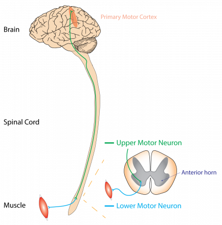 Моторные нейроны головного мозга станут целью терапии бокового амиотрофического склероза