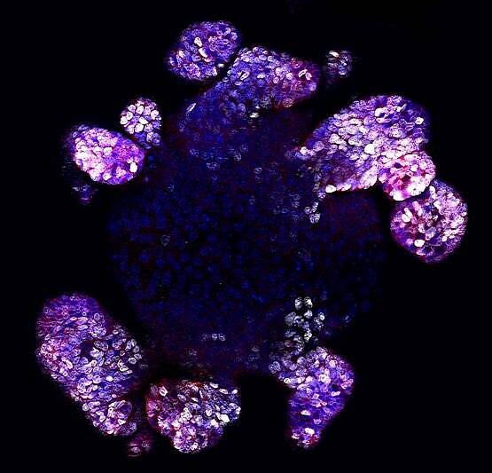 Открыты молекулы, способные ускорить процессы регенерации слизистой оболочки кишечника