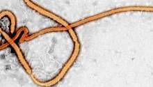 Новая вспышка Эболы заставляет предположить, что вирус может «прятаться» в организме человека годами     