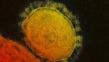 Ученые нашли способ заразить мышь коронавирусом. Это поможет в разработке вакцины и действенных способов лечения ковид-19