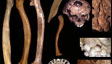 Антропологи назвали причину появления анатомических аномалий у древних людей