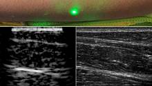 Ученые впервые сделали лазерную ультразвуковую диагностику дистанционно