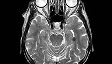 С помощью портативного сканера МРТ мозга можно будет делать прямо в машине скорой помощи
