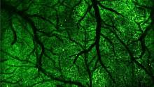 Высокоскоростной микроскоп отслеживает мимолетные сигналы в мозге