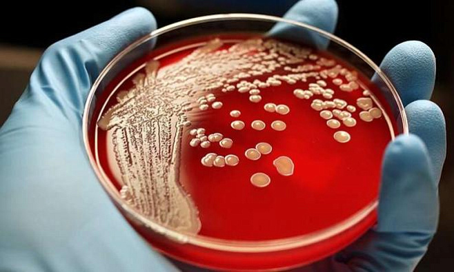 Создано вещество, способное убивать резистентные бактерии двух типов
