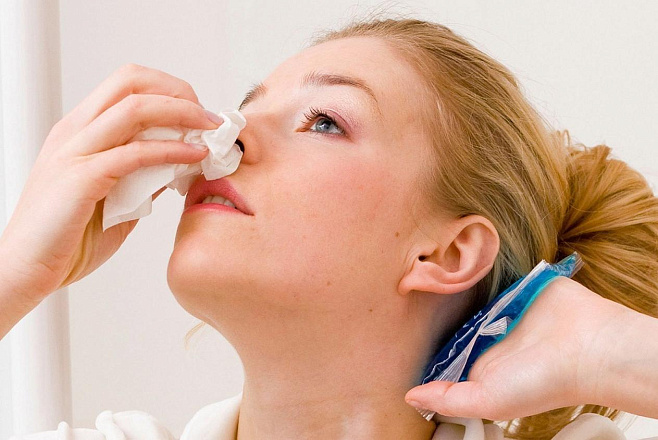 Кровотечение из носа может сигнализировать о риске гипертонии 