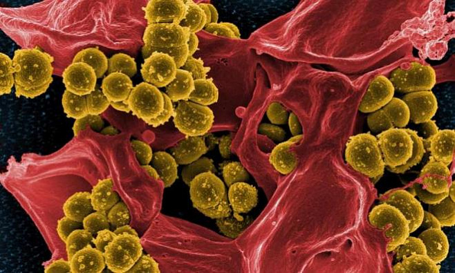 Новая информация о структуре бактерий и антибиотикорезистентности