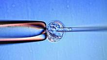 В Японии новорожденному пересадили стволовые клетки 