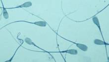 Коронавирус обнаружен в образцах спермы