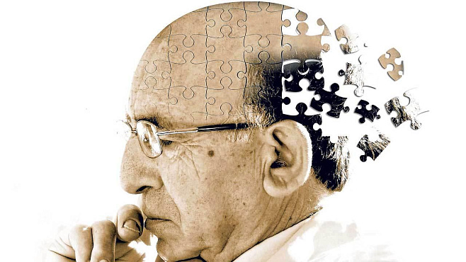Нейробиологи нашли новый способ изучения причин болезни Альцгеймера