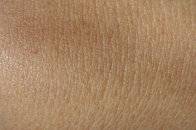 Новый алгоритм Google диагностирует заболевания кожи