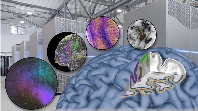 Изучение мозга человека предъявляет новые требования к суперкомпьютерам