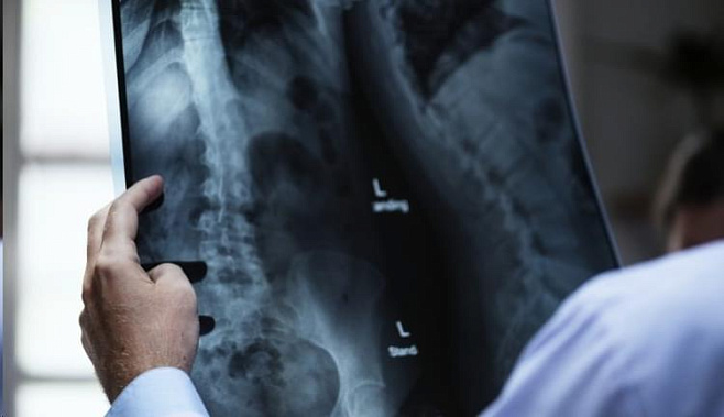 Российские ученые приблизились к созданию искусственных костей
