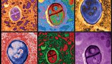 Микробы, живущие внутри раковых опухолей, могут помочь в борьбе с раком