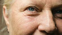 Хирургия катаракты снижает риск развития деменции