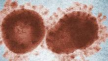 Ученые предполагают, что вирус COVID-19 находился в организме человека в течение многих лет 