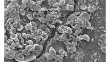 Патогенные грибы колонизируют микропластик в почве