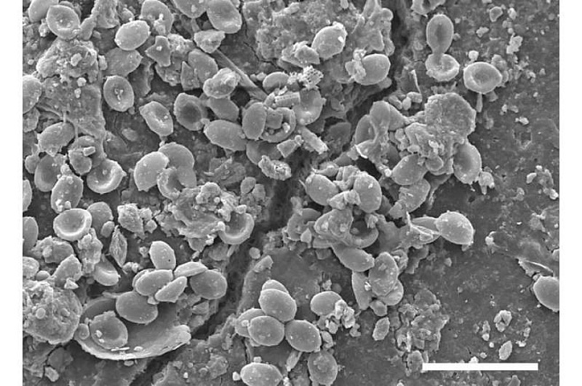 Патогенные грибы колонизируют микропластик в почве