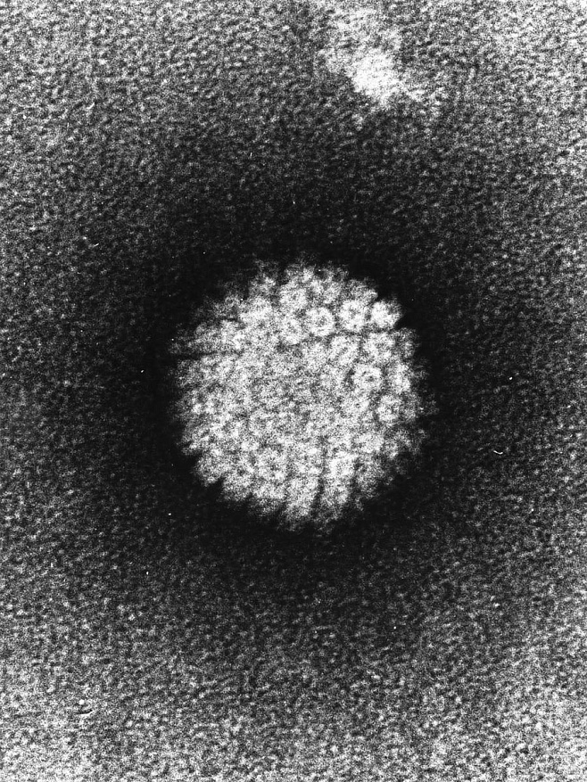 Ученые нашли новый способ блокирования вируса ВПЧ вызывающего рак