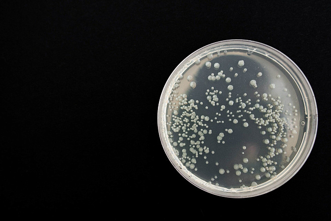 Новый тест позволит быстро отличать бактериальные инфекции от вирусных