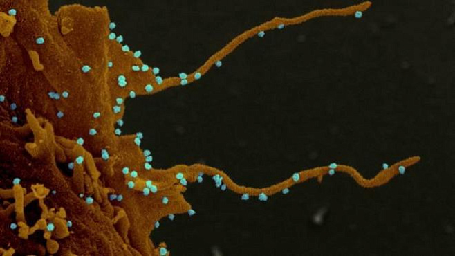 Учёные обнаружили «зловещие щупальца» у заражённых коронавирусом клеток