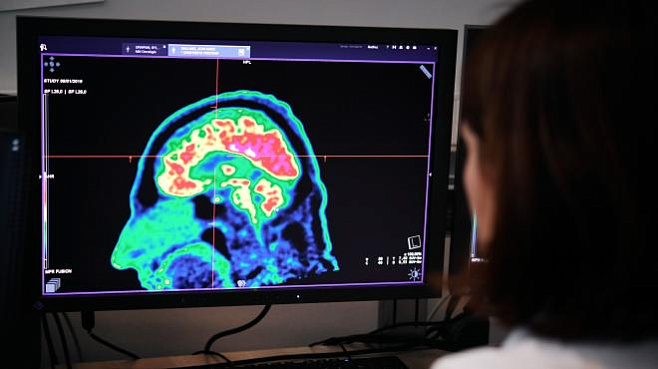 Ученые нашли связь между биполярным расстройством и нейровоспалением