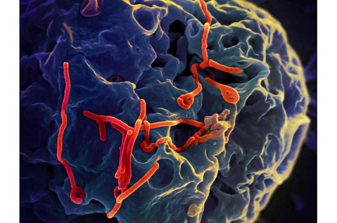 Определены белки, защищающие организм от вмруча Эбола