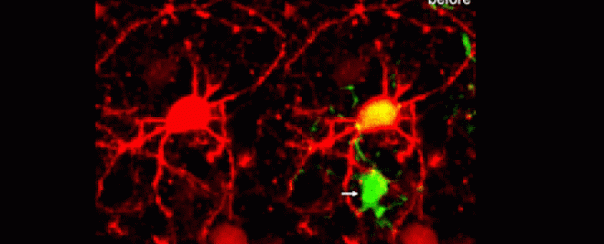 Ученые впервые засняли процесс очищения мозга от мертвых нейронов