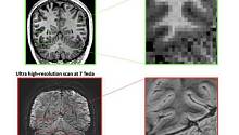 Распознавание лиц и предметов связаны с разными участками коры мозга