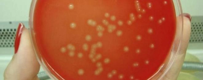 Бактерия, вызывающая инфекции мочеполовой системы, строит свою ДНК из.. мочи 