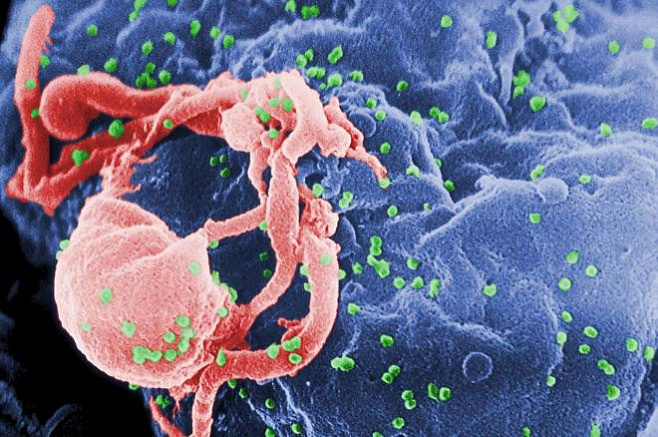 Биологи впервые проследили, как ВИЧ проникает в человеческие клетки и вставляет свой геном в их ДНК