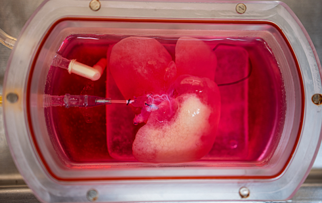 Выращенную из человеческих клеток мини-печень пересадили мышам. Пациенты отлично себя чувствуют